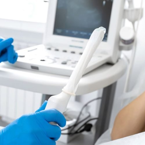 US Transvaginal